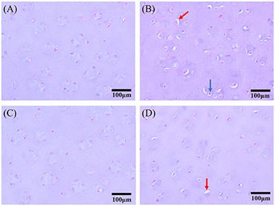 Autophagy in Femoral Head Necrosis of Broilers Bone Metabolism Parameters and Autophagy-Related Gene Expression in Femoral Head Necrosis Induced by Glucocorticoid in Broilers